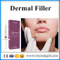 Lip Fullness Sodium Hyaluronate Acid Dermal Filler Injection